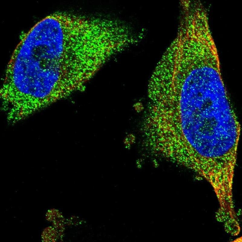 Staining of human cell line U-251 MG shows localization to cytosol.