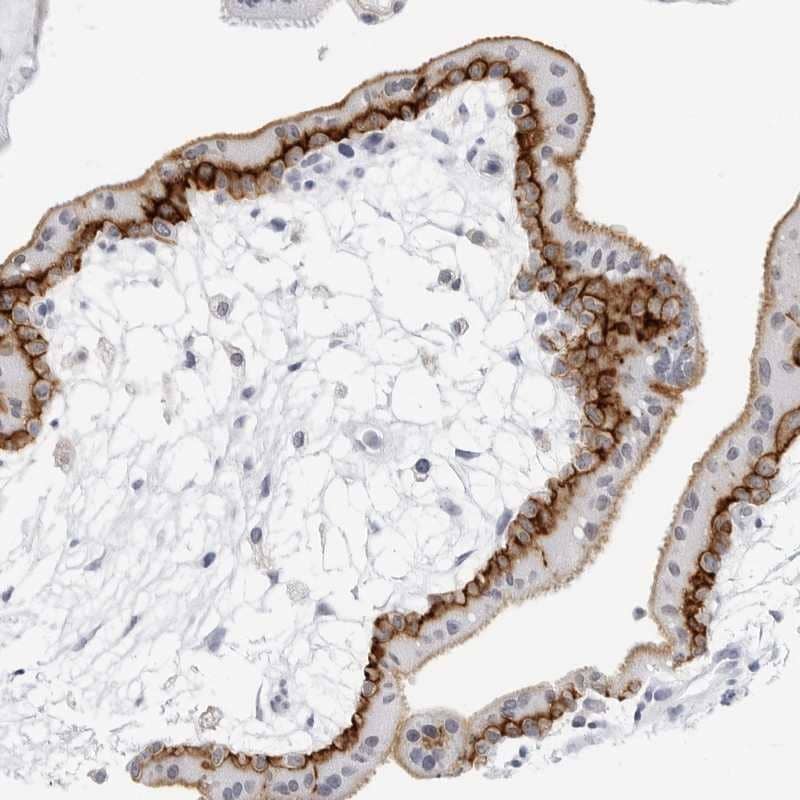 Staining of human placenta shows strong membranous positivity in trophoblastic cells.