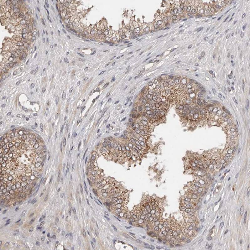 Immunohistochemistry-Paraffin MDP1 Antibody - BSA Free