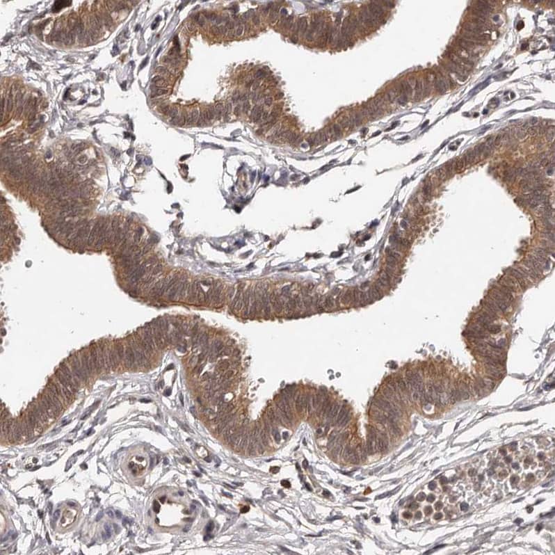 Staining of human fallopian tube shows moderate cytoplasmic positivity in glandular cells.