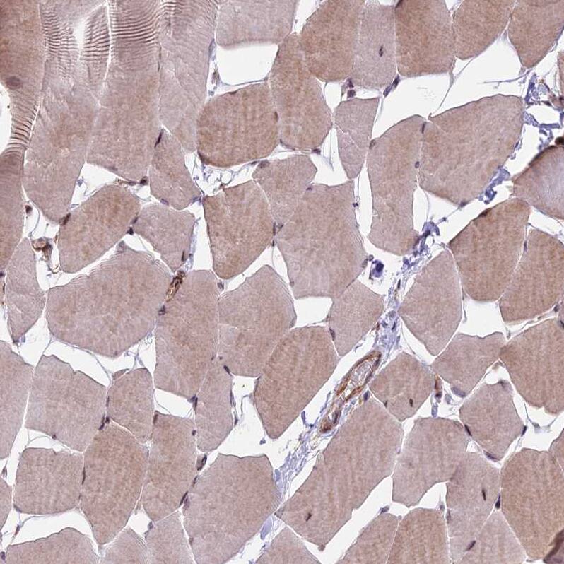 Immunohistochemistry-Paraffin HDAC5 Antibody - BSA Free