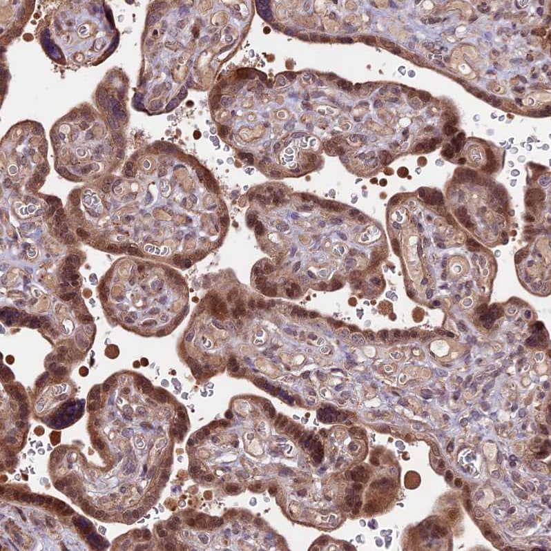 Immunohistochemistry-Paraffin HDAC5 Antibody - BSA Free