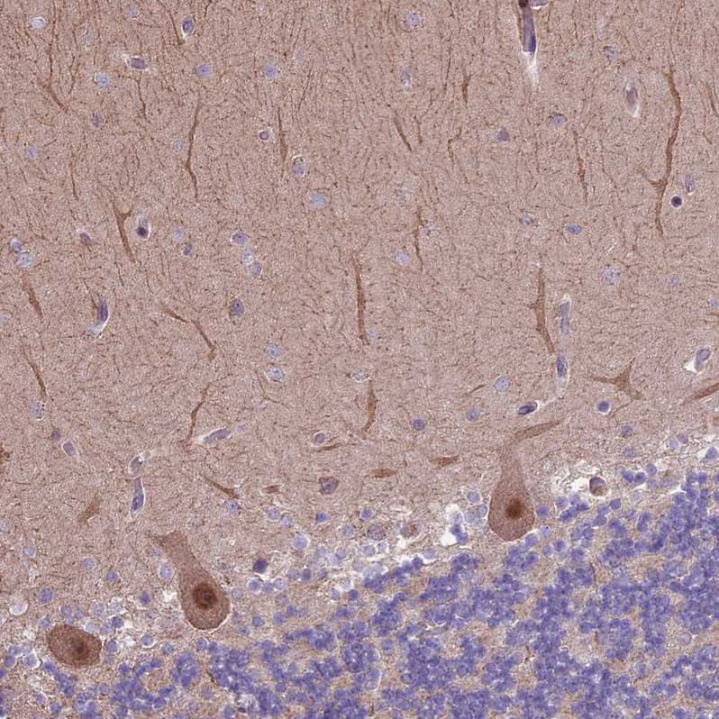 Immunohistochemistry-Paraffin HDAC5 Antibody - BSA Free