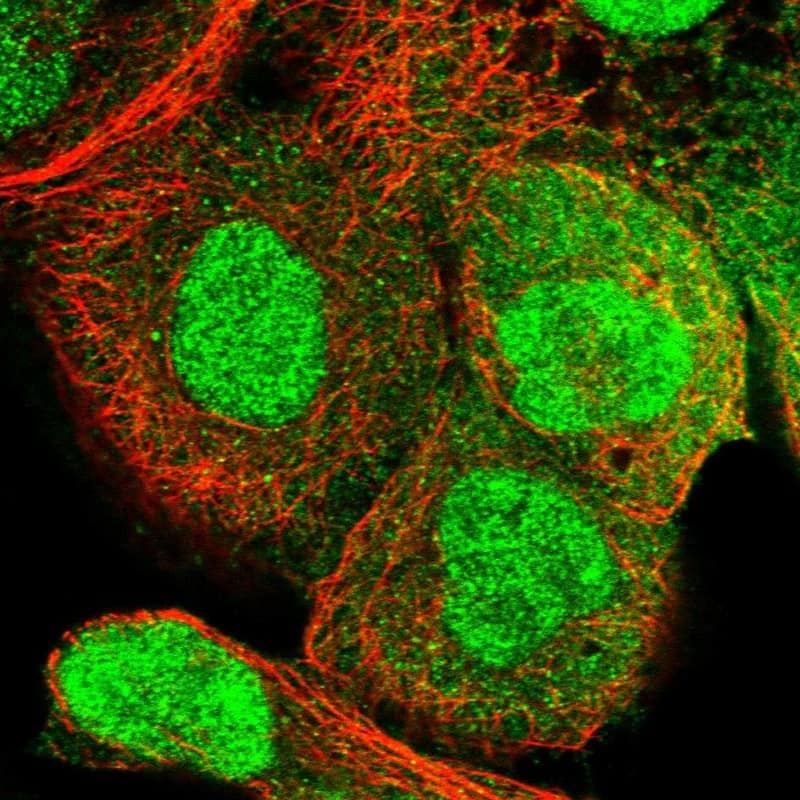 Staining of human cell line A-431 shows localization to nucleus & cytosol.