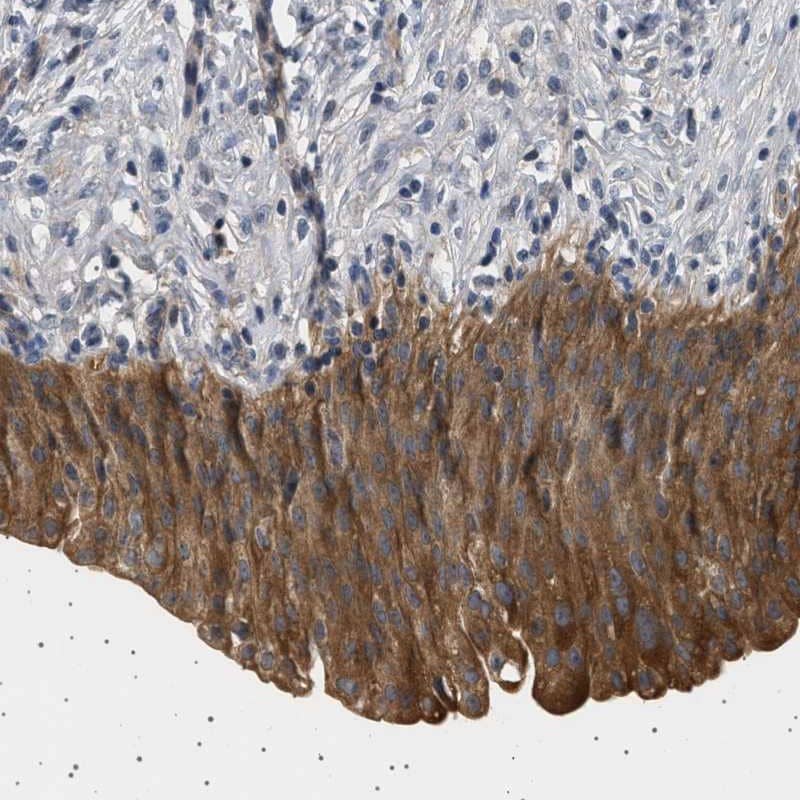 Staining of human urinary bladder shows strong cytoplasmic positivity in urothelial cells.