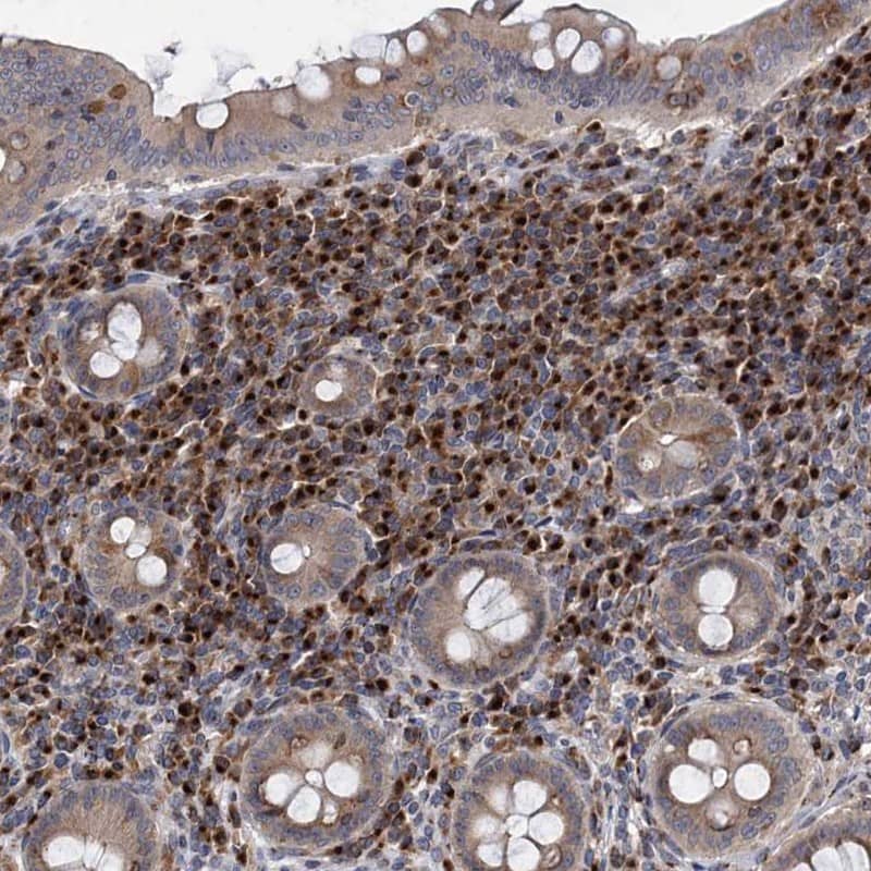 <b>Independent Antibodies Validation. </b>Staining of human appendix shows cytoplasmic positivity in lymphoid tissue.