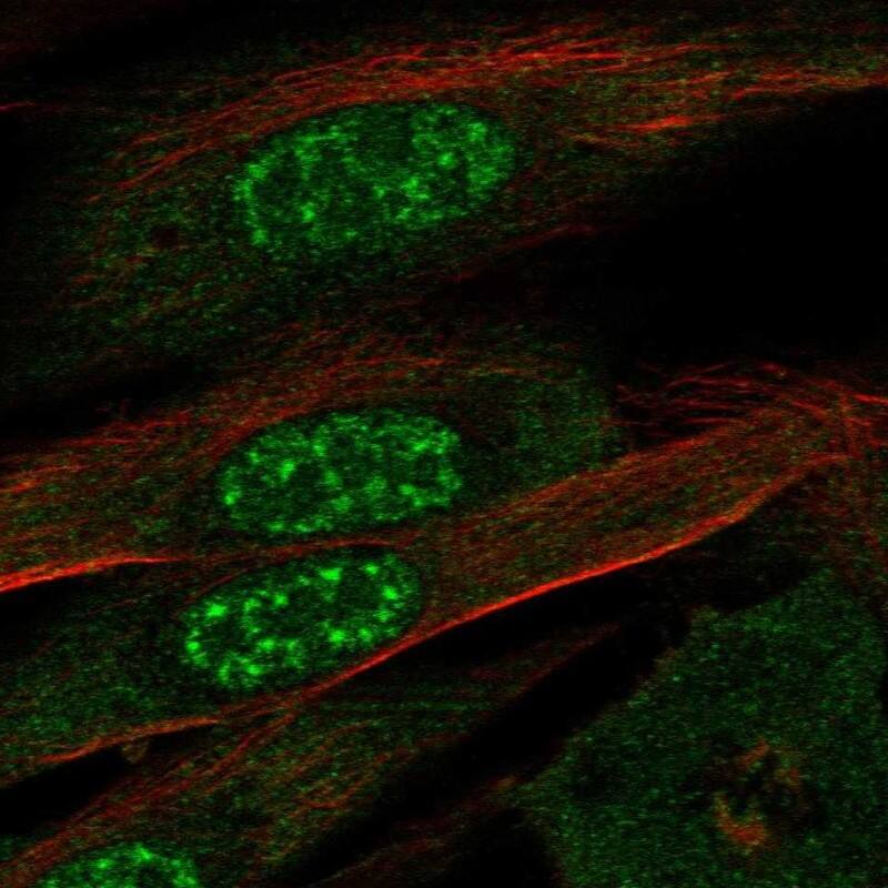 Staining of human cell line ASC TERT1 shows localization to nuclear speckles & cytosol.