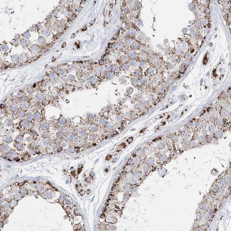 Staining of human testis shows granular cytoplasmic positivity in cells in seminiferous ducts.