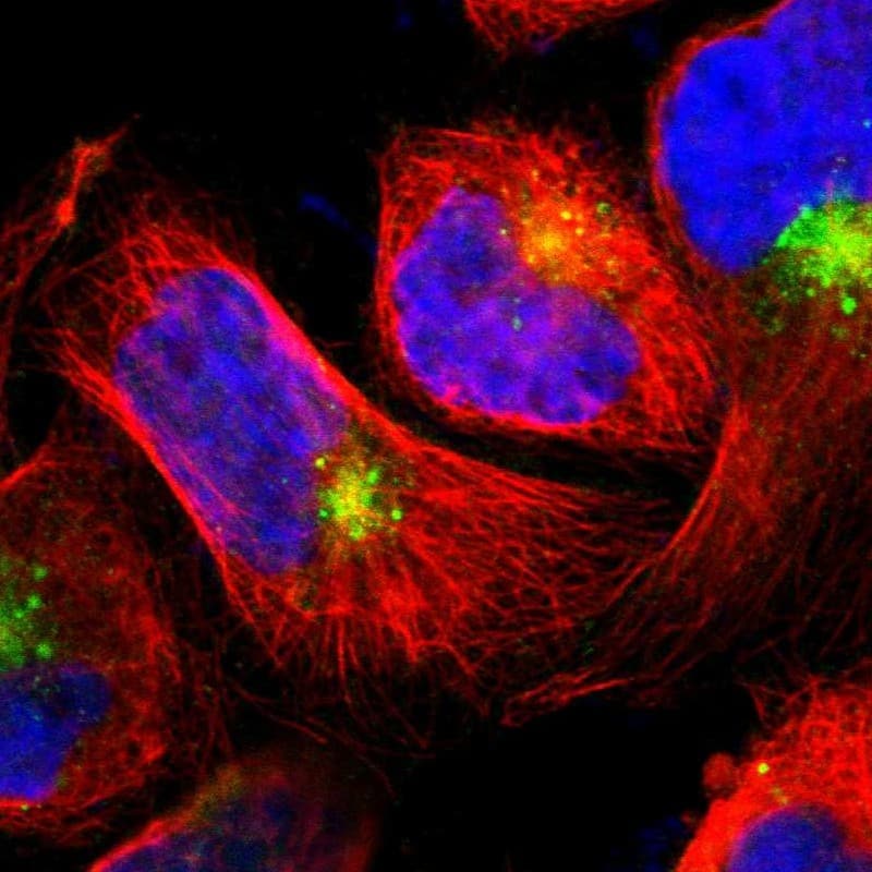Staining of human cell line A-431 shows localization to nucleoplasm & vesicles.
