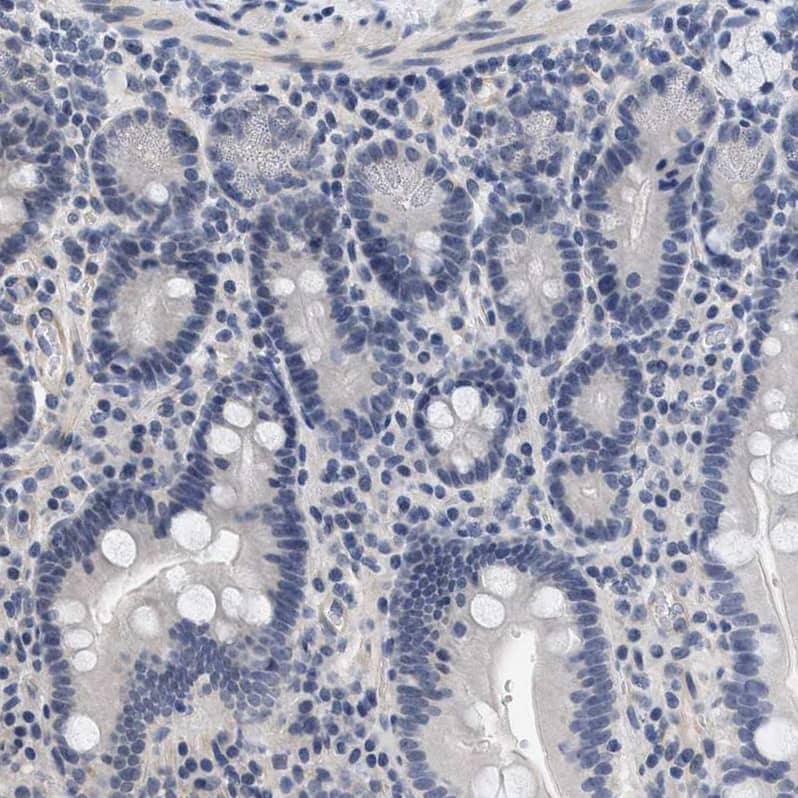 Staining of human duodenum shows no positivity in glandular cells as expected.