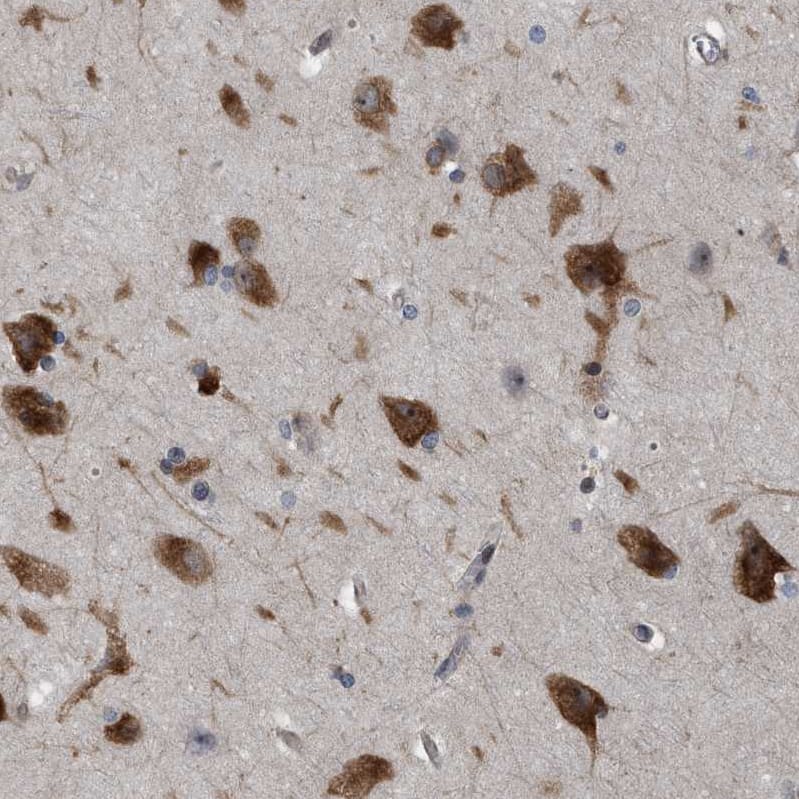 Staining of human cerebral cortex shows strong cytoplasmic positivity in neurons.