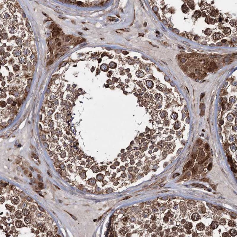 Immunohistochemistry-Paraffin HECTD2 Antibody - BSA Free