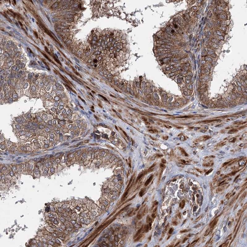 Staining of human Prostate shows strong cytoplasmic positivity in smooth muscle and glandular cells.