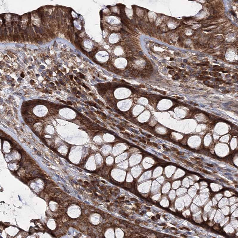 Staining of human Rectum shows strong cytoplasmic positivity in glandular cells.