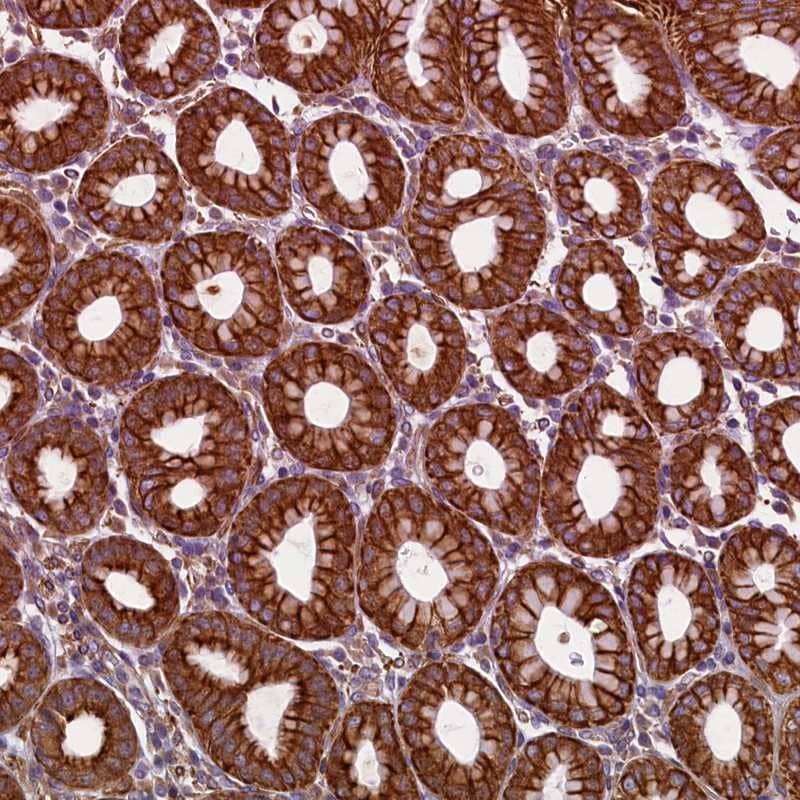 Immunohistochemistry-Paraffin LRRC57 Antibody - BSA Free