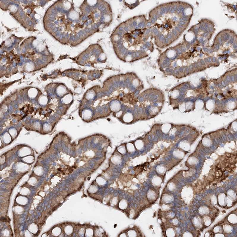 Staining of human small intestine shows moderate cytoplasmic and membranous positivity in glandular cells.