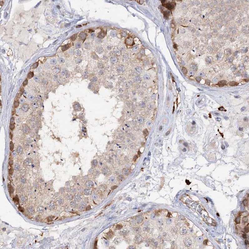 Staining of human testis shows moderate cytoplasmic and membranous positivity in cells in seminiferous ducts.