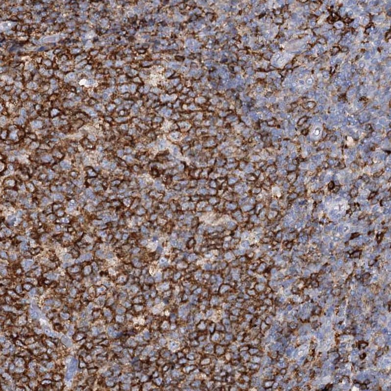 Staining of human tonsil shows moderate cytoplasmic and membranous positivity in germinal and non germinal center cells.