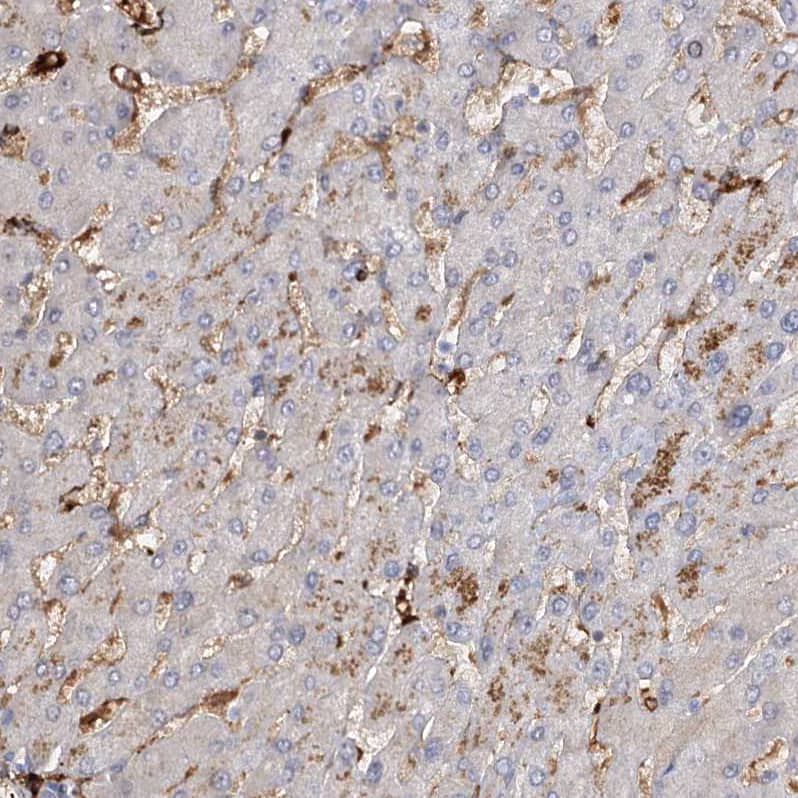 Staining of human liver shows no positivity in hepatocytes as expected.