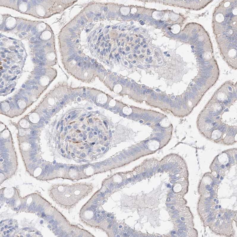 Immunohistochemistry-Paraffin RNF175 Antibody - BSA Free