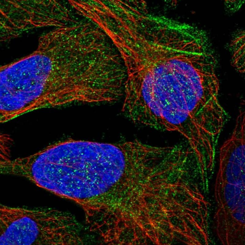 Immunocytochemistry/ Immunofluorescence LYSMD4 Antibody - BSA Free