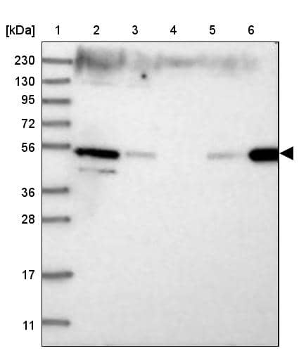 Western Blot ZFYVE27 Antibody - BSA Free