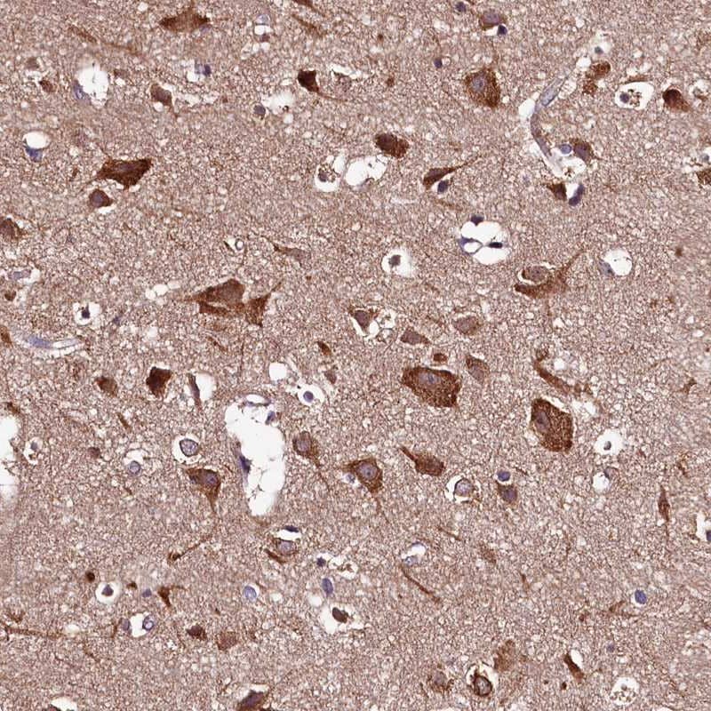 Staining of human cerebral cortex shows strong cytoplasmic positivity in neuronal cells.