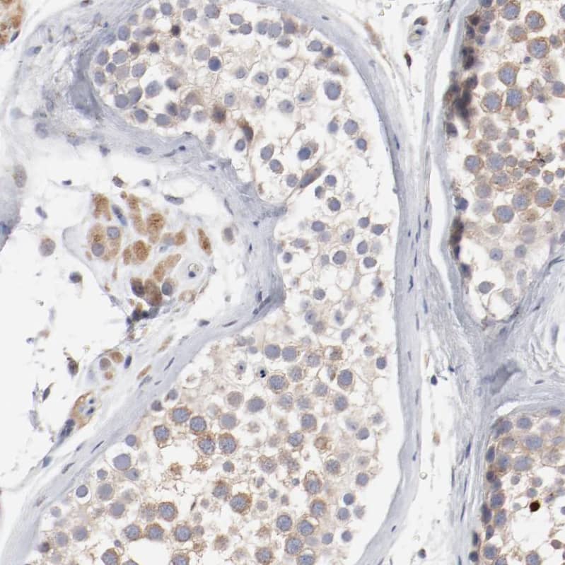 Immunohistochemistry-Paraffin AK7 Antibody - BSA Free