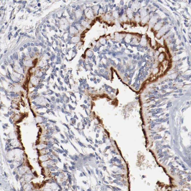 Immunohistochemistry-Paraffin AK7 Antibody - BSA Free