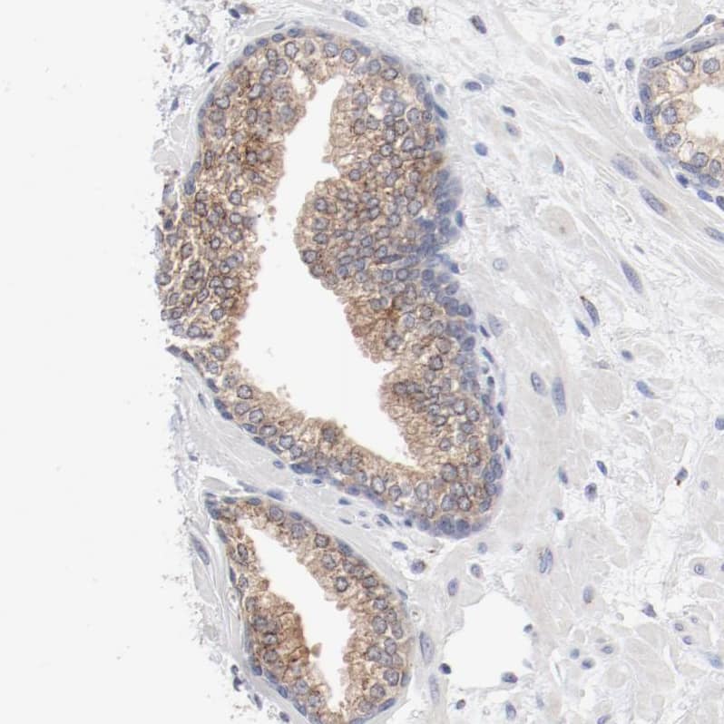 Immunohistochemistry-Paraffin AK7 Antibody - BSA Free