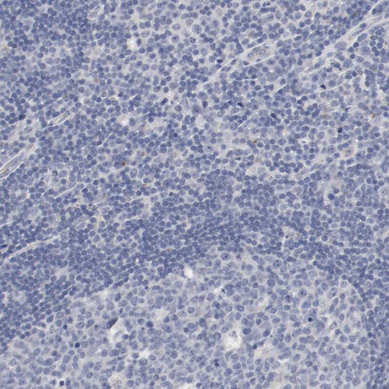 Immunohistochemistry-Paraffin AK7 Antibody - BSA Free