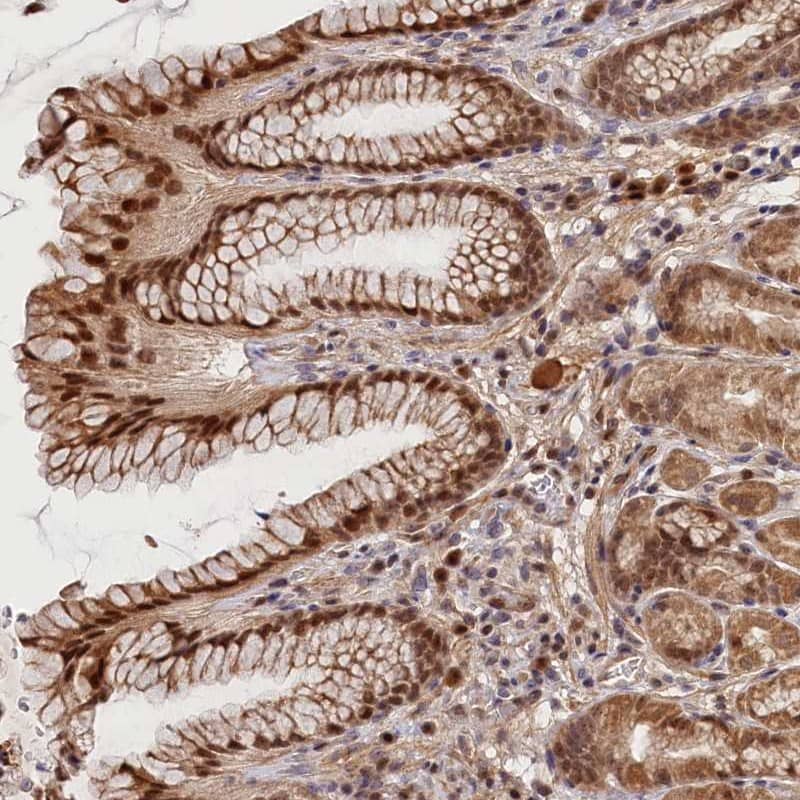 Staining of human stomach, lower shows strong nuclear positivity in glandular cells.