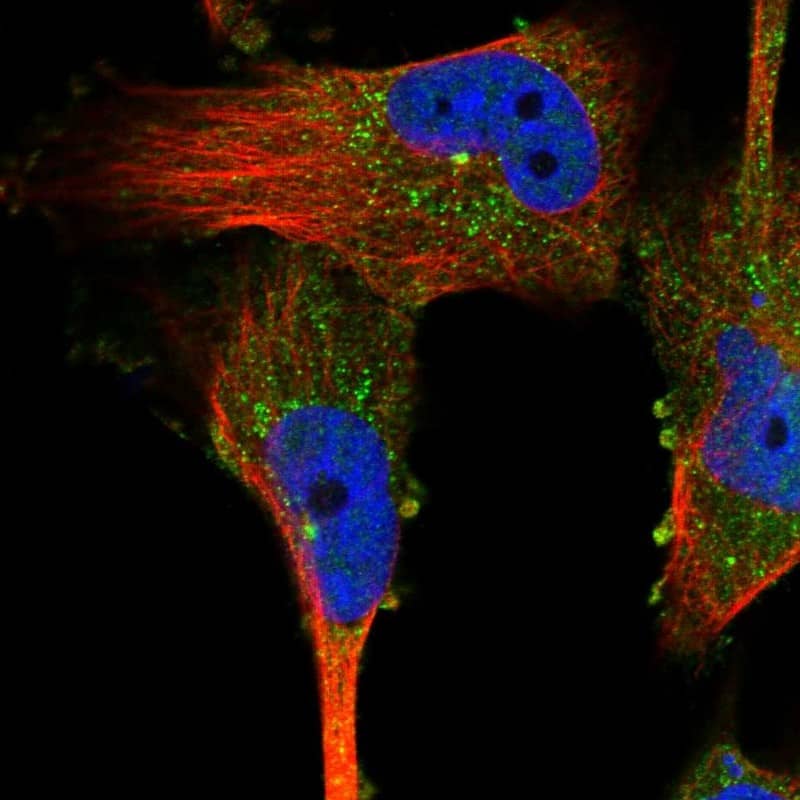 Staining of human cell line U-251 MG shows localization to cytosol, centrosome & vesicles.