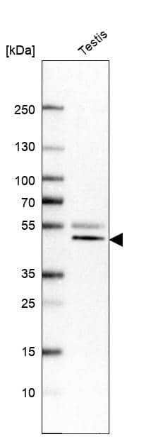 Analysis in human testis tissue.