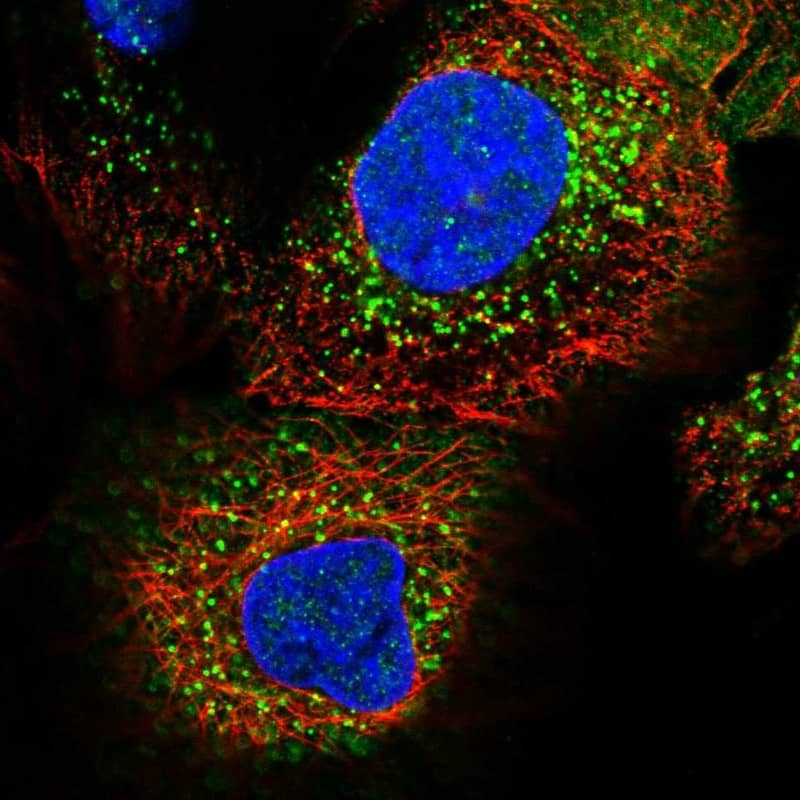 Staining of human cell line A-431 shows localization to vesicles.