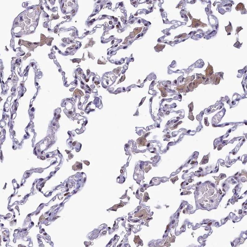 Immunohistochemistry-Paraffin ANKS3 Antibody - BSA Free