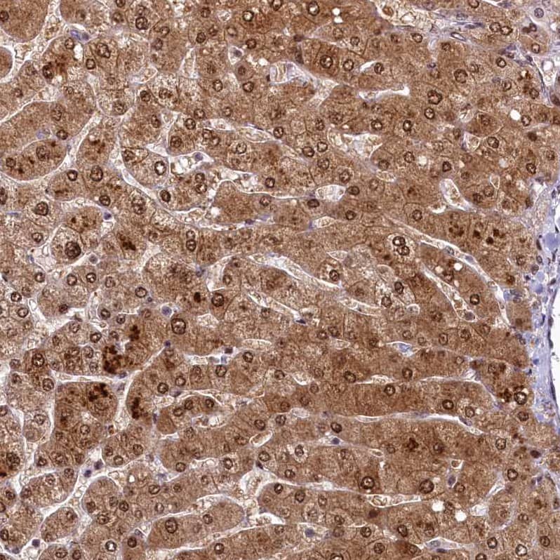 Immunohistochemistry-Paraffin ANKS3 Antibody - BSA Free