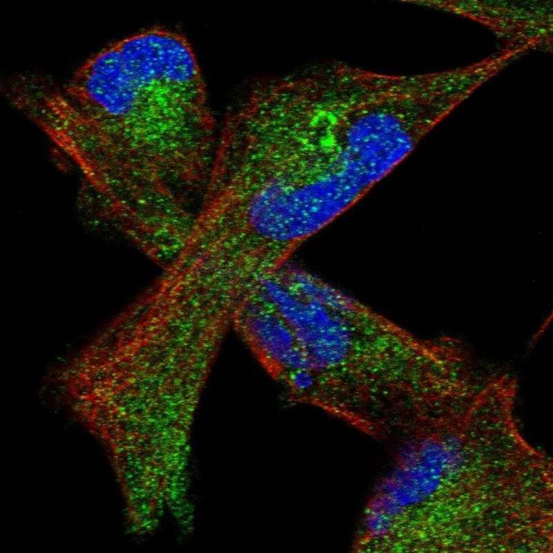 Staining of human cell line RH-30 shows localization to cytosol.