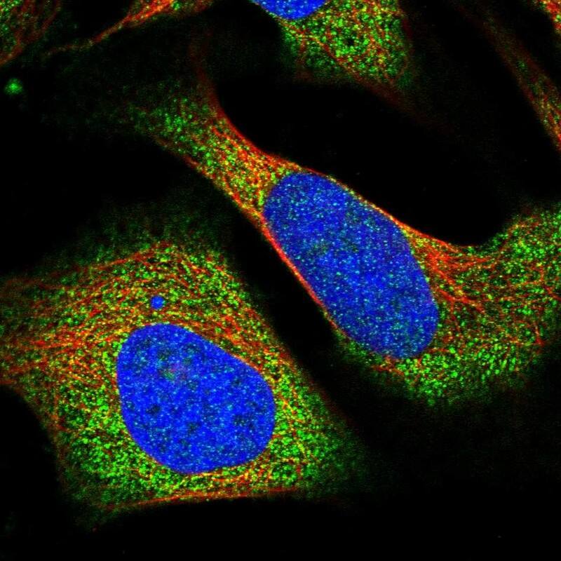 Immunocytochemistry/ Immunofluorescence Layilin Antibody - BSA Free