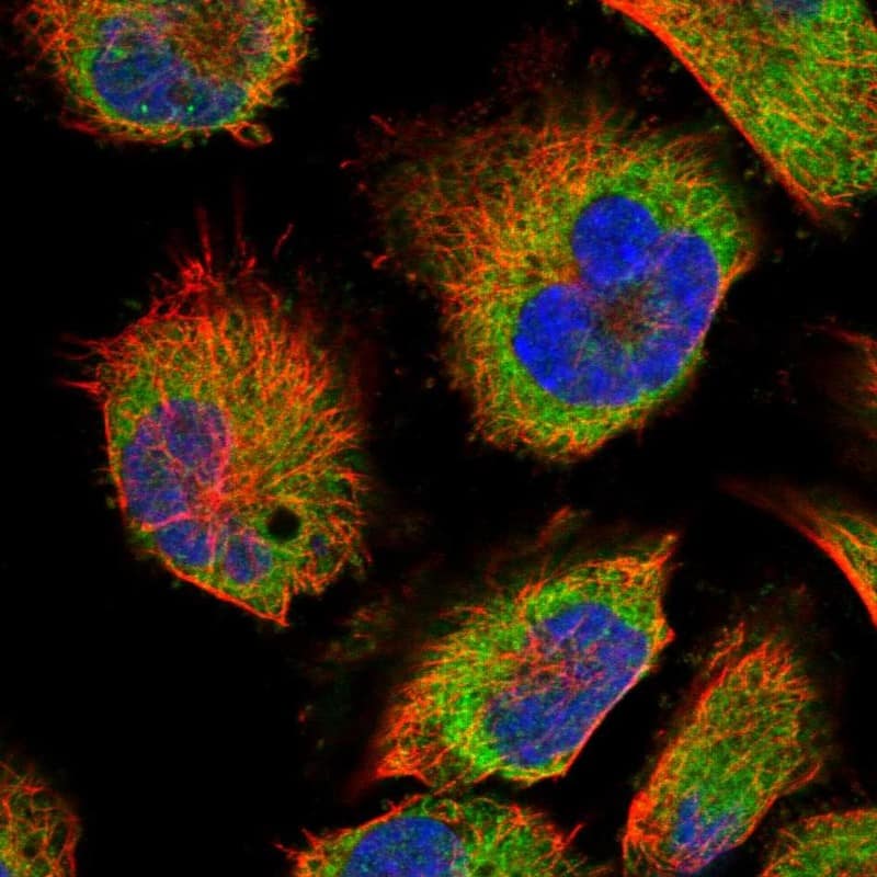 Staining of human cell line U-251 MG shows localization to endoplasmic reticulum.