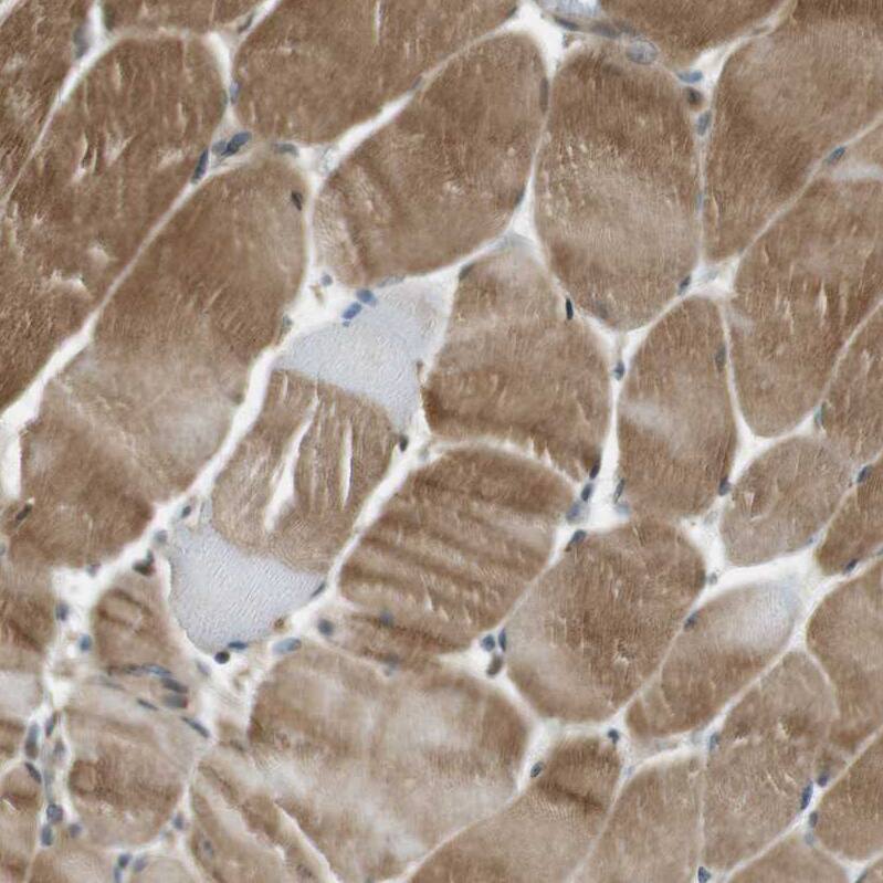Staining of human skeletal muscle moderate cytoplasmic positivity in myocytes.
