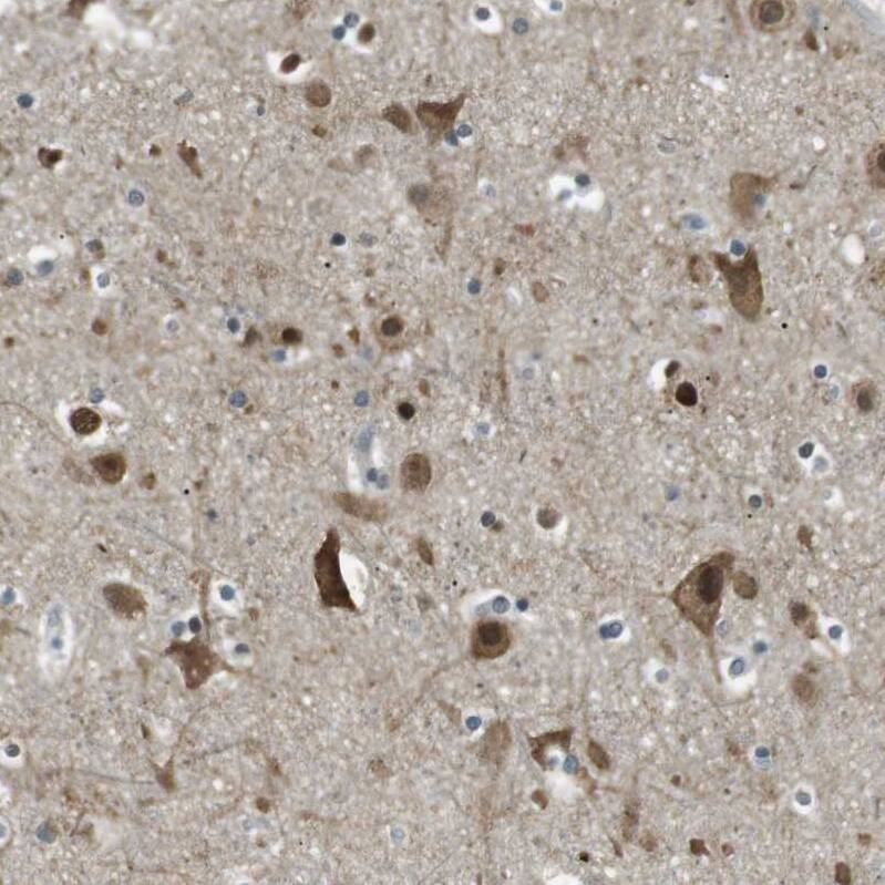 Staining of human cerebral cortex shows moderate membranous-cytoplasmic positivity in neuronal cells in addition to moderate nucleus positivity.