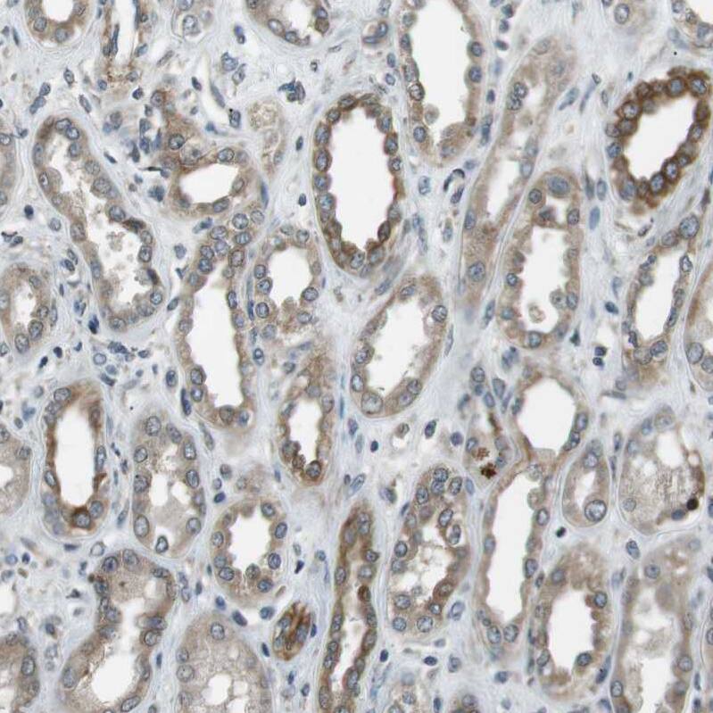 Staining of human kidney shows moderate membranous-cytoplasmic positivity in cells in tubules.