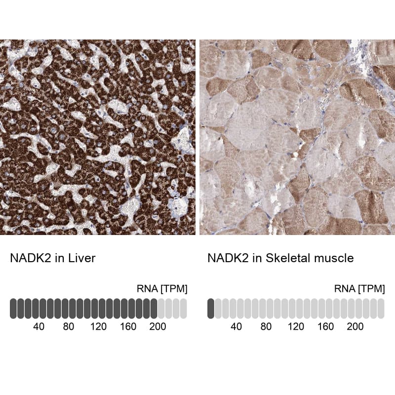 Immunohistochemistry-Paraffin NADKD1 Antibody - BSA Free
