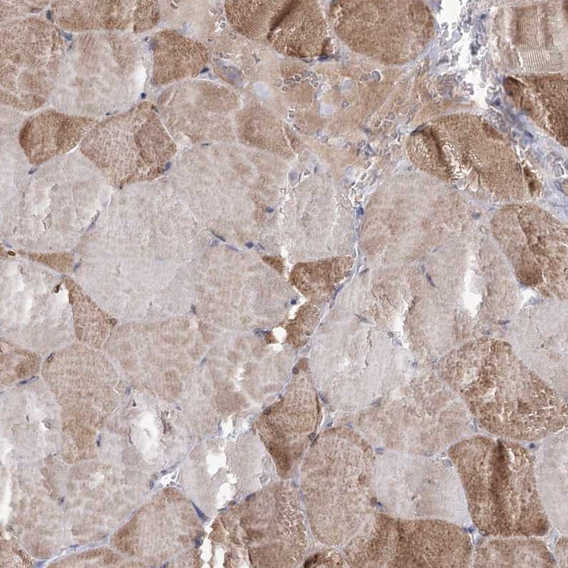 Immunohistochemistry-Paraffin NADKD1 Antibody - BSA Free