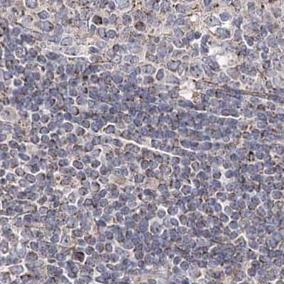 Immunohistochemistry-Paraffin NADKD1 Antibody - BSA Free