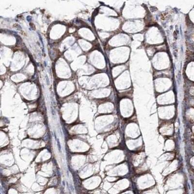 Immunohistochemistry-Paraffin NADKD1 Antibody - BSA Free