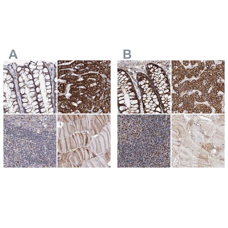 Immunohistochemistry-Paraffin NADKD1 Antibody - BSA Free