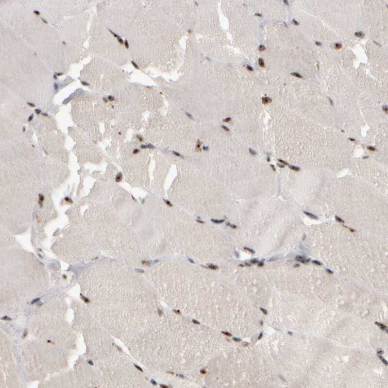 Staining of human skeletal muscle shows strong positivity in nucleoli in myocytes.
