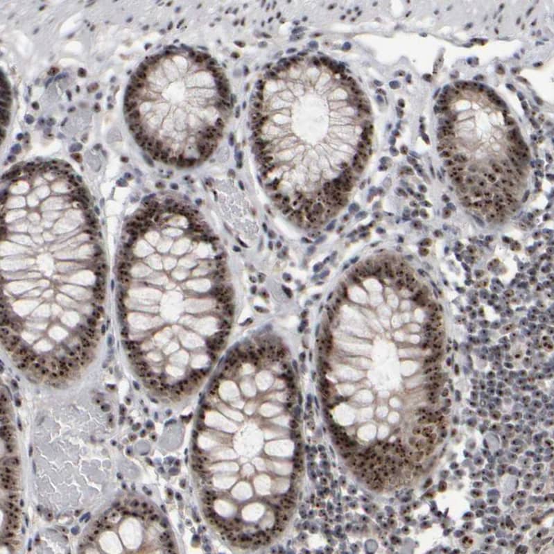 Staining of human colon shows strong positivity in nucleoli in glandular cells and lymphoid cells.